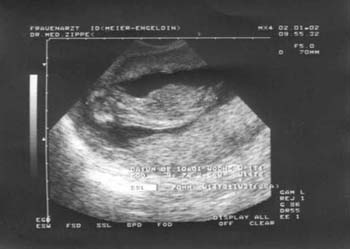 baby-bild003-02012002